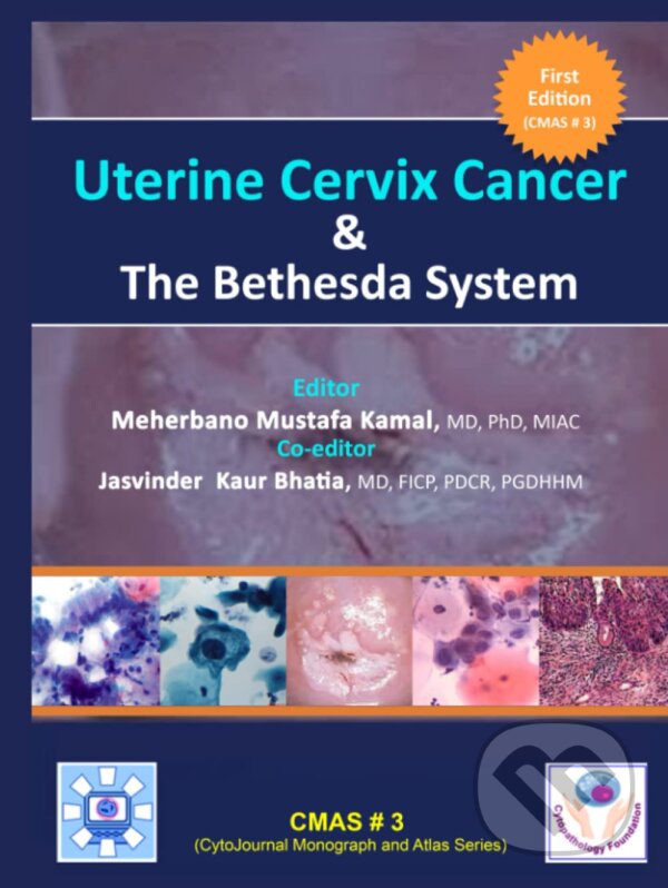 Levně Uterine Cervix Cancer The Bethesda System - Meherbano Mustafa Kamal - kniha z kategorie Medicína