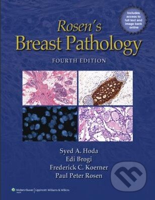 Levně Rosen's Breast Pathology (Fourth edition) - Syed A. Hoda, Edi Brogi, Frederick C. Koerner, Paul Peter Rosen - kniha z kategorie Odborné a náučné