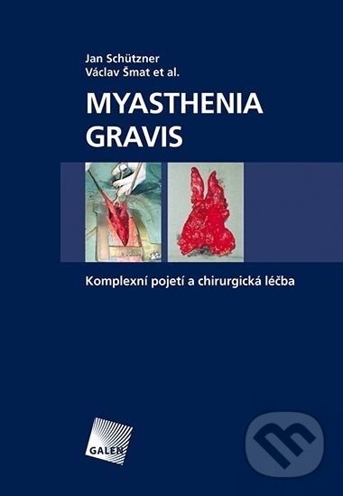 Levně Myasthenia gravis (Komplexní pojetí a chirurgická léčba) - kniha z kategorie Všeobecná chirurgia