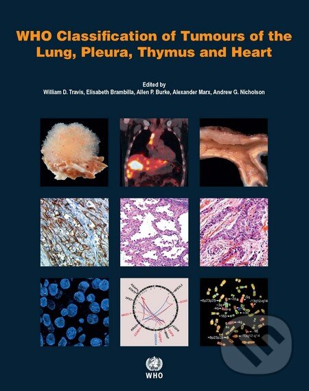 Levně Who Classification of Tumours of the Lung, Pleura, Thymus and Heart - kniha z kategorie Odborné a náučné