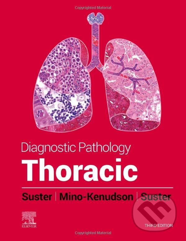 Kniha Diagnostic Pathology: Thoracic