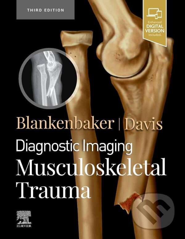 Levně Diagnostic Imaging: Musculoskeletal Trauma - Donna G. Blankenbaker, Kirkland W. Davis