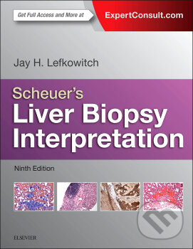 Levně Scheuer's Liver Biopsy Interpretation - Jay Lefkowitch - kniha z kategorie Odborné a náučné