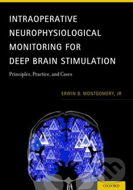 Levně Intraoperative Neurophysiological Monitoring for Deep Brain Stimulation - kniha z kategorie Neurológia