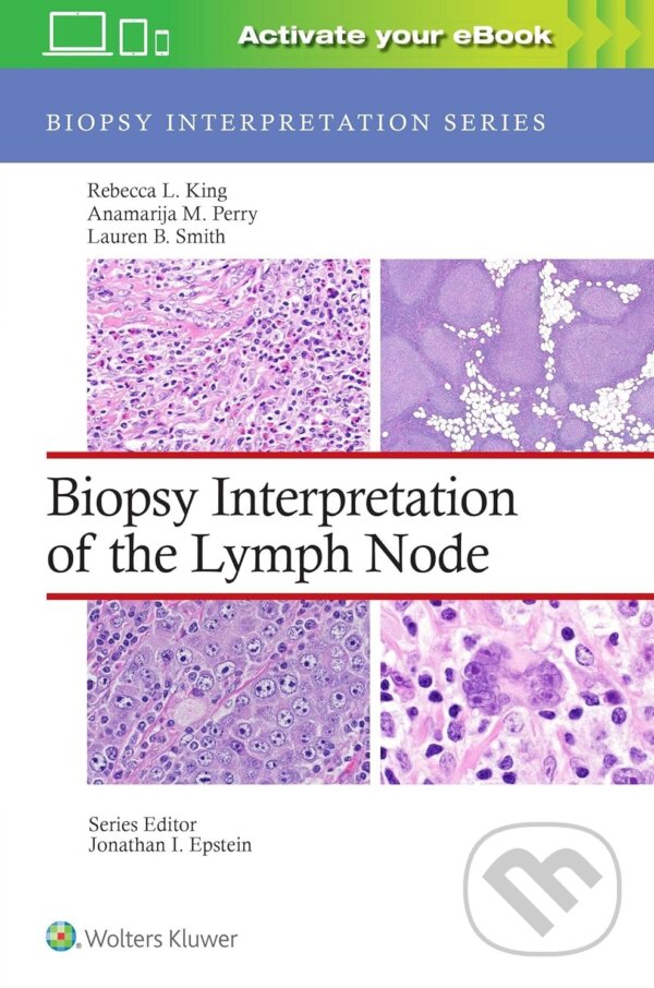 Levně Biopsy Interpretation of the Lymph Node - Anamarija M. Perry, Lauren B. Smith, Rebecca Leigh King - kniha z kategorie Medicína