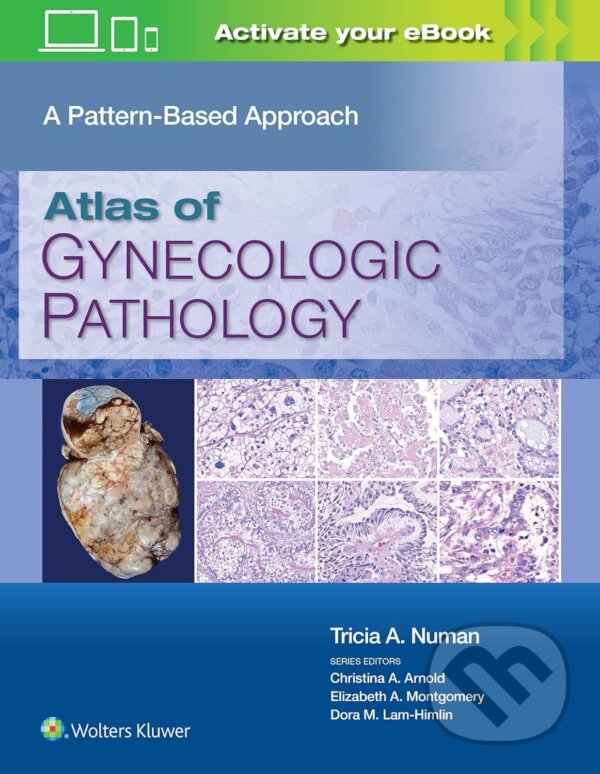 Levně Atlas of Gynecologic Pathology (A Pattern-Based Approach) - kniha z kategorie Gynekológia