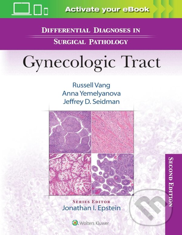 Levně Differential Diagnoses in Surgical Pathology: Gynecologic Tract - kniha z kategorie Gynekológia