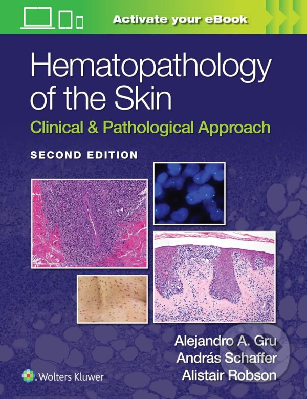 Levně Hematopathology of the Skin (Clinical & Pathological Approach) - kniha z kategorie Hematológia