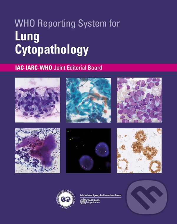 Levně WHO Reporting System for Lung Cytopathology - kniha z kategorie Medicína