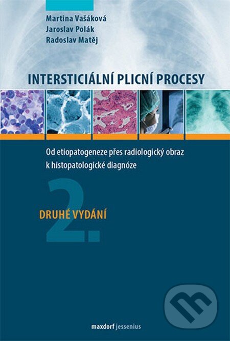 Levně Intersticiální plicní procesy (2.vydání - Od etiopatogeneze přes radiologický obraz k histopatologické diagnóze) - kniha z kategorie Medicína