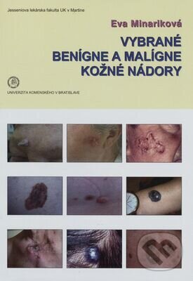 Levně Vybrané benígne a malígne kožné nádory - Eva Mináriková - kniha z kategorie Vysoké školy