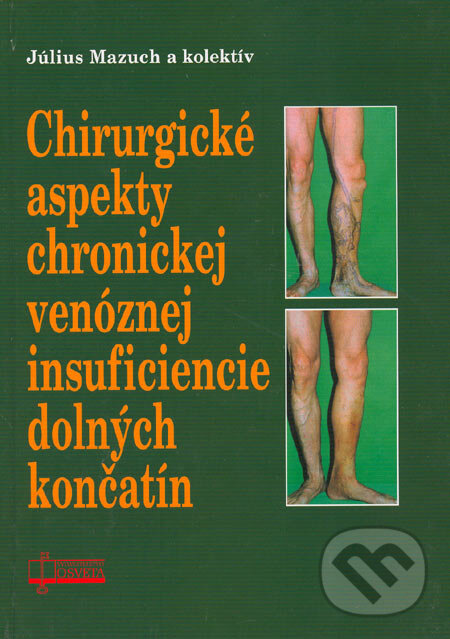 Levně Chirurgické aspekty chronickej venóznej insuficiencie dolných končatín - kniha z kategorie Kardiovaskulárne chirurgia