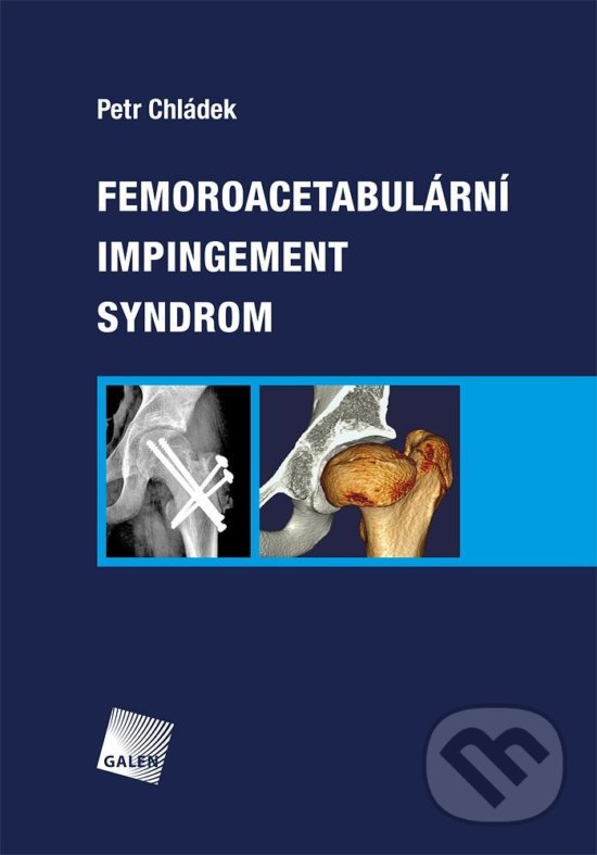 Levně Femoroacetabulární impingement syndrom - Petr Chládek - kniha z kategorie Medicína