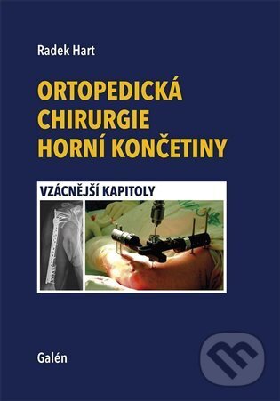 Ortopedická chirurgie horní končetiny - Vzácnější kapitoly koupíte na Martinus.cz