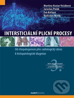 Levně Intersticiální plicní procesy - Kolektiv - kniha z kategorie Farmakológia a fytoterapia