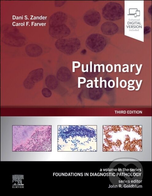Levně Pulmonary Pathology - Carol F. Farver, Dani S. Zander, John R. Goldblum - kniha z kategorie Medicína