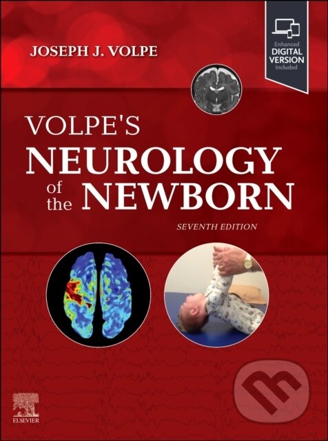 Kniha: Volpe's Neurology of the Newborn (Joseph J. Volpe a Terrie E. Inder)