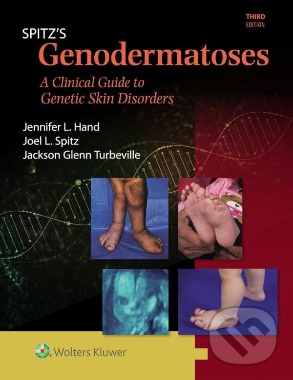 Levně Spitz's Genodermatoses (A Full Color Clinical Guide to Genetic Skin Disorders) - kniha z kategorie Dermatológia