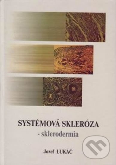 Kniha: Systémová skleróza - sklerodermia (Jozef Lukáč). Osveta, 1998