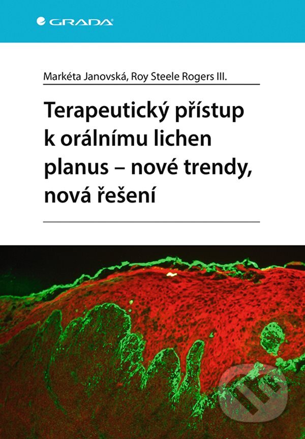 Terapeutický přístup k orálnímu lichen planus - nové trendy, nová řešení koupíte na Martinus.cz