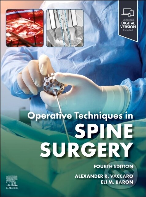 Levně Operative Techniques Spine Surgery - Alexander R. Vaccaro, Eli M. Baron - kniha z kategorie Chirurgia