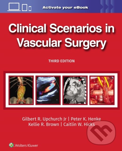 Levně Clinical Scenarios In Vascular Surgery 3 - Caitlin Whitney, PETER HENKE, Kellie R., M.D. Brown, GILBERT R., JR UPCHURCH - kniha z kategorie Chirurgia