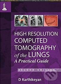 Levně High Resolution Computed Tomography of the Lungs (A Practical Guide) - kniha z kategorie Medicína