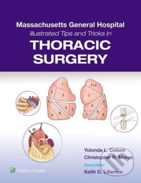 Levně Massachusetts General Hospital Illustrated Tips and Tricks in Thoracic Surgery - kniha z kategorie Chirurgia