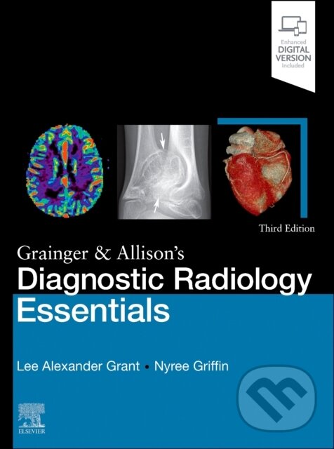 Levně Grainger & Allison's Diagnostic Radiology Essentials - kniha z kategorie Medicína