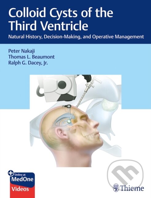 Levně Colloid Cysts of the Third Ventricle (Natural History, Decision-Making, and Operative Management) - kniha z kategorie Medicína