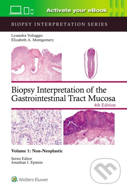 Kniha: Biopsy Interpretation of the Gastrointestinal Tract Mucosa Volume 1 (ELIZABETH ANNE MONTGOMERY a Lysandra Voltaggio)