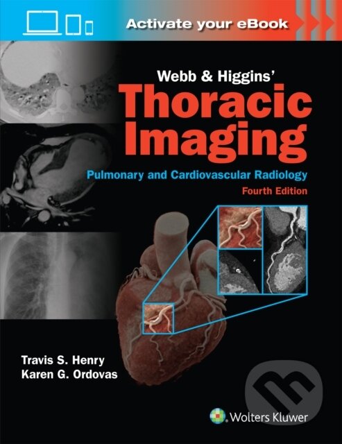 Kniha: Webb & Higgins Thoracic Imaging: Print + eBook with Multimedia (Travis Scott Henry a Karen Gomes Ordovas). Wolters Kluwer Health, 2024