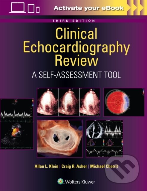 Levně Clinical Echocardiography Review: A Self-Assessment Tool: Print +with Multimedia - kniha z kategorie Kardiológia a Angiológia