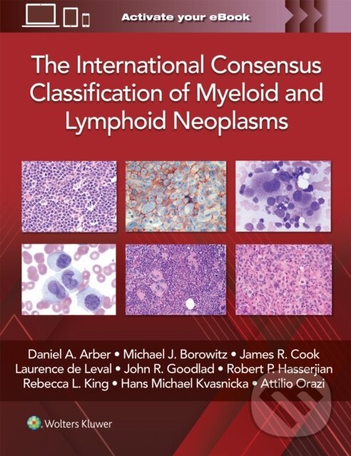 Kniha: The International Consensus Classification of Myeloid and Lymphoid Neoplasms (Daniel A. Arber)