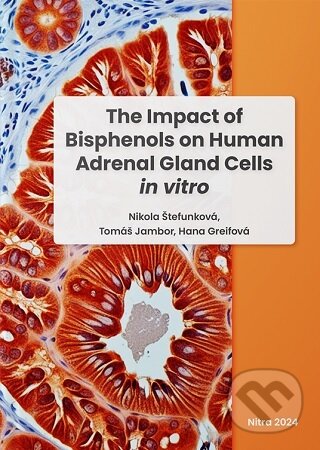 Levně The Impact of Bisphenols on Human Adrenal Gland Cells in vitro - kniha z kategorie Medicína