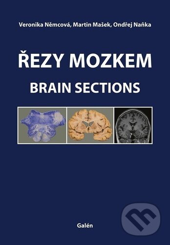 Levně Řezy mozkem (Atlas makroskopických, mikroskopických a MRI řezů) - kniha z kategorie Vysoké školy