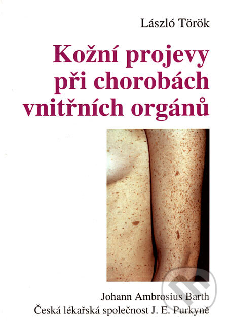 Kniha: Kožní projevy při chorobách vnitřních orgánů (László Török). J. A. Barth Verlag, Česká lékařská společnost J. E. Purkyně, 1998