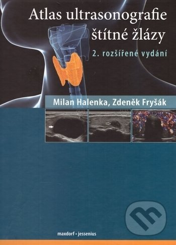 Atlas ultrasonografie štítné žlázy - Milan Halenka, Zdeněk Fryšák, Maxdorf, 2018