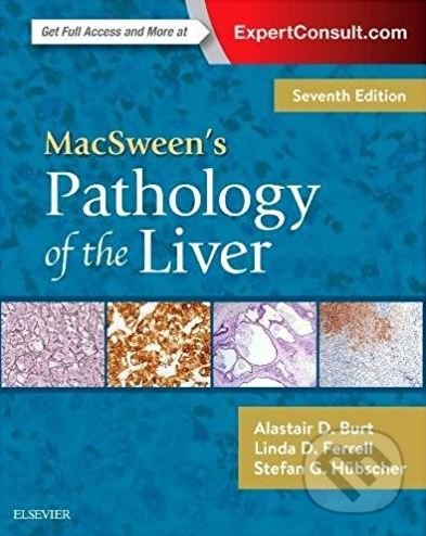 Levně MacSween's Pathology of the Liver - Alastair D. Burt, Linda D. Ferrell, Stefan G. Hubscher - kniha z kategorie Medicína