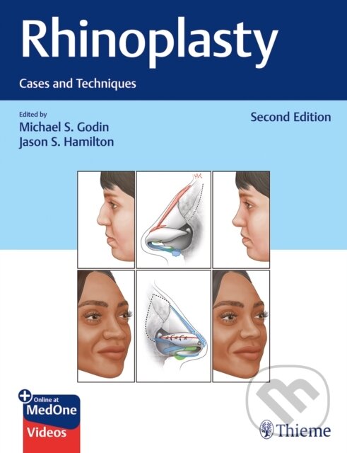 Levně Rhinoplasty (Cases and Techniques) - Jason S. Hamilton, Michael S. Godin - kniha z kategorie Oftalmológia a otolaryngologia