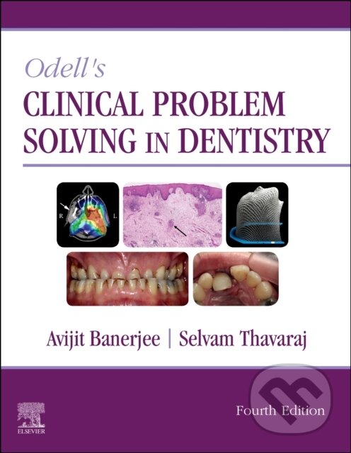 Levně Odell's Clinical Problem Solving in Dentistry, 4th Edition - kniha z kategorie Medicína