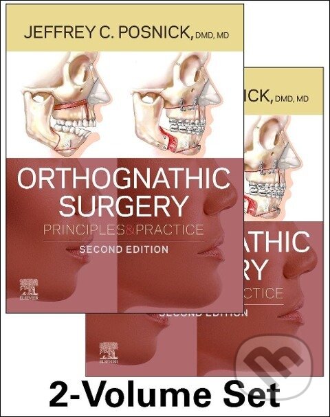 Kniha: Orthognathic Surgery - 2 Volume Set (Jeffrey C. Posnick). , 2022