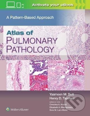 Kniha: Atlas of Pulmonary Pathology : A Pattern Based Approach (Mahmood Yasmeen Butt). Lippincott Williams & Wilkins, 2021