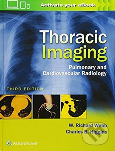 Kniha Thoracic Imaging