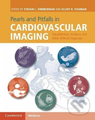 Levně Pearls and Pitfalls in Cardiovascular Imaging (Pseudolesions, Artifacts, and Other Difficult Diagnoses) - kniha z kategorie Medicína