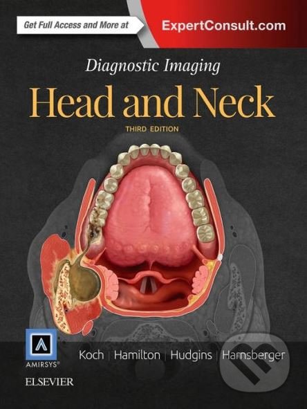 Levně Diagnostic Imaging (Head and Neck) - kolektív autorov - kniha z kategorie Medicína
