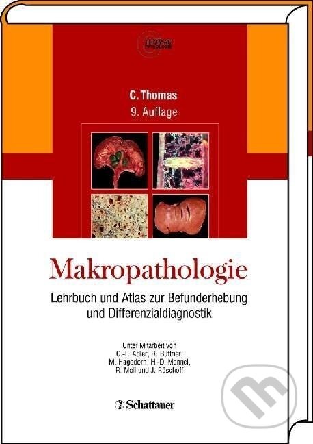 Kniha: Makropathologie (Carlos Thomas). Schattauer, 2003