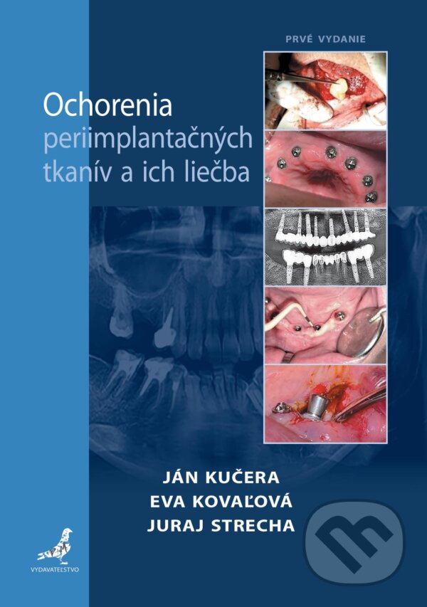 Levně Ochorenia periimplantačných tkanív a ich liečba - Juraj Strecha, Eva Kovaľová, Ján Kučera - kniha z kategorie Stomatológia a dentálna hygiena