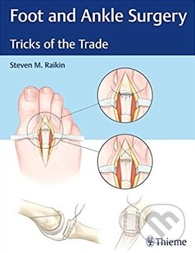 Levně Foot and Ankle Surgery - Steven Raikin - kniha z kategorie Medicína