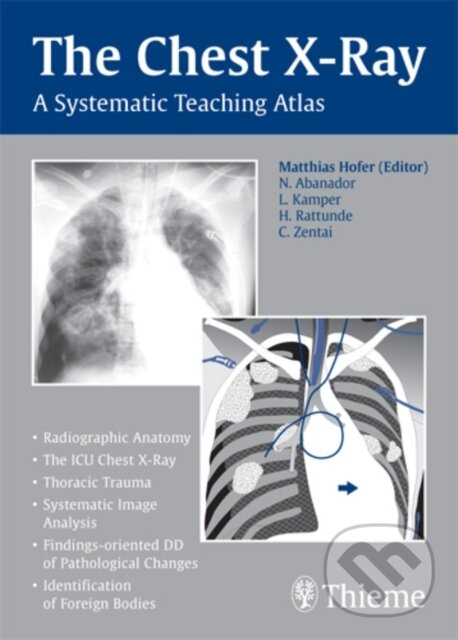 Levně Chest X-ray Trainer - Matthias Hofer - kniha z kategorie Medicína